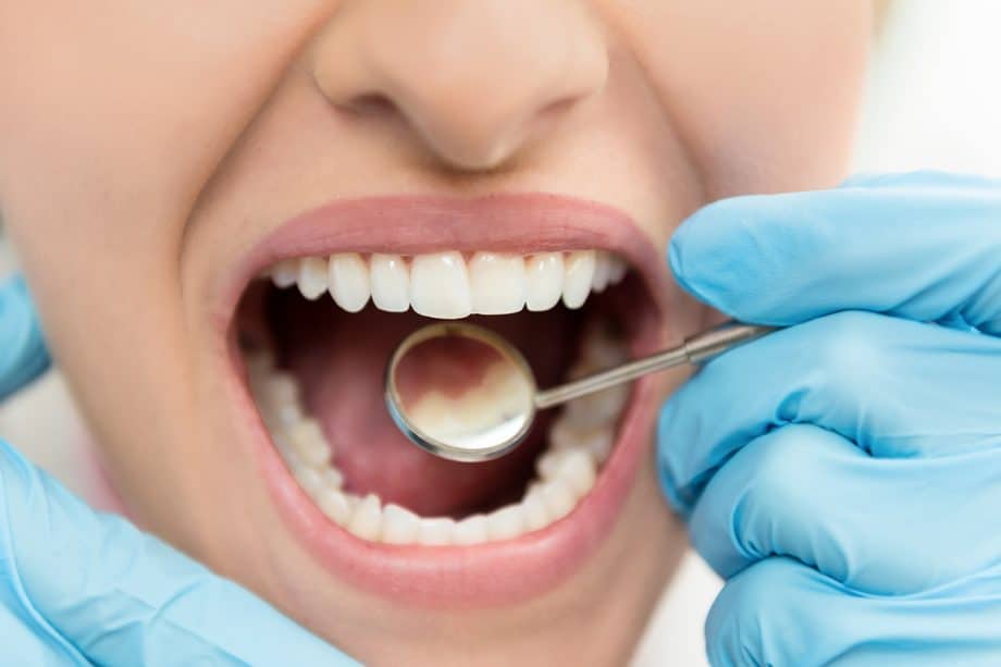 What Age Should a Child Go To the Dentist?